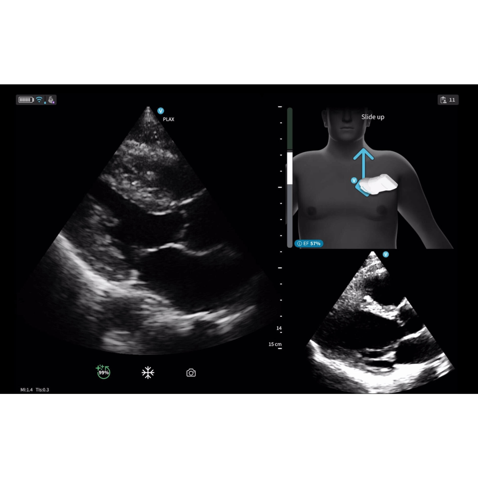 Caption AI™ for Vscan Air™ SL Caption AI™ for Vscan Air™ SL